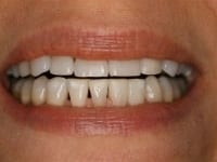 Konig Center for Cosmetic & Comprehensive Dentistry smile photos